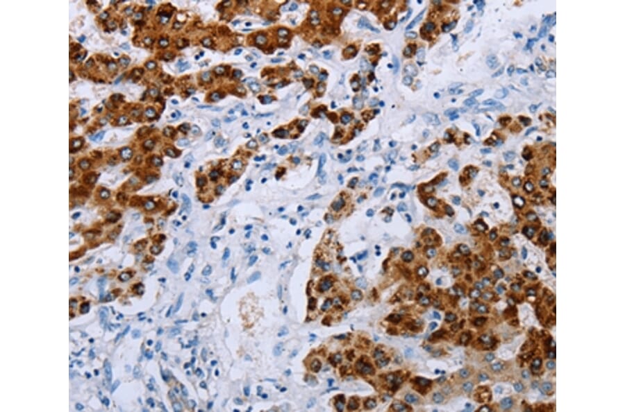 Immunohistochemistry - NDUFA12 Antibody from Signalway Antibody (36824) - Antibodies.com