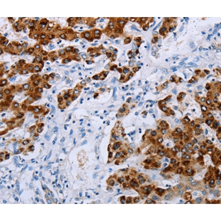 Immunohistochemistry - NDUFA12 Antibody from Signalway Antibody (36824) - Antibodies.com