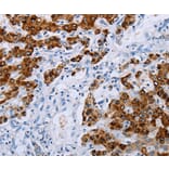 Immunohistochemistry - NDUFA12 Antibody from Signalway Antibody (36824) - Antibodies.com