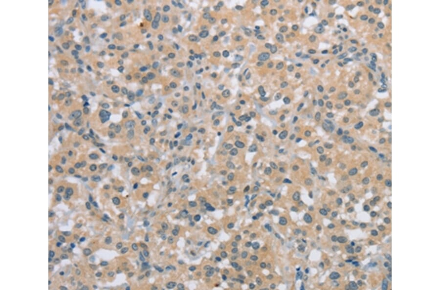 Immunohistochemistry - C2orf40 Antibody from Signalway Antibody (36833) - Antibodies.com