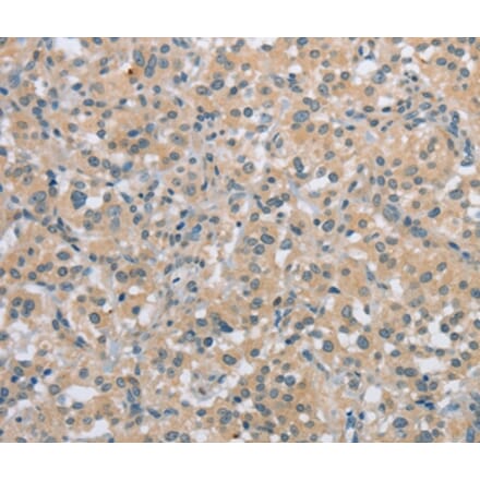 Immunohistochemistry - C2orf40 Antibody from Signalway Antibody (36833) - Antibodies.com