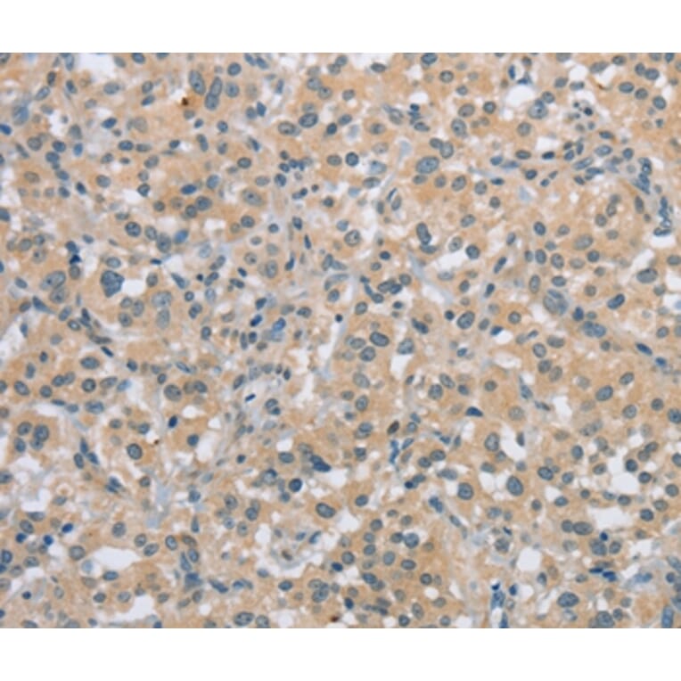 Immunohistochemistry - C2orf40 Antibody from Signalway Antibody (36833) - Antibodies.com