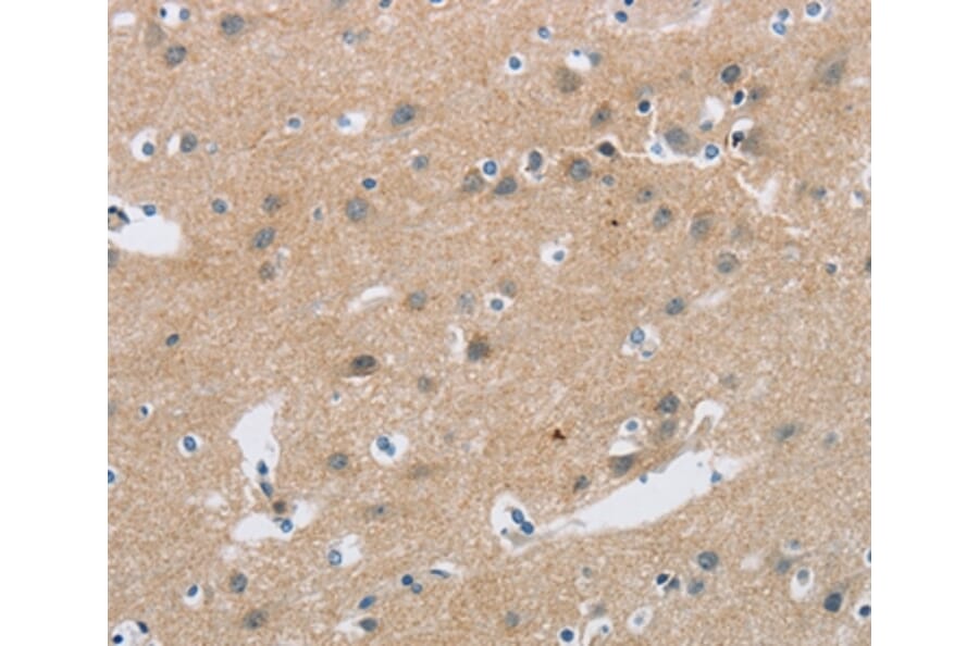 Immunohistochemistry - C2orf40 Antibody from Signalway Antibody (36833) - Antibodies.com