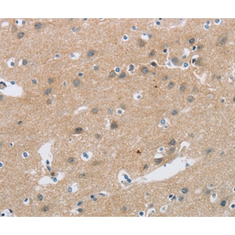 Immunohistochemistry - C2orf40 Antibody from Signalway Antibody (36833) - Antibodies.com