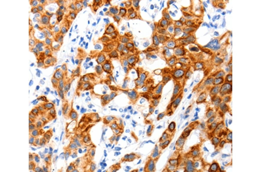 Immunohistochemistry - SLC2A11 Antibody from Signalway Antibody (36905) - Antibodies.com