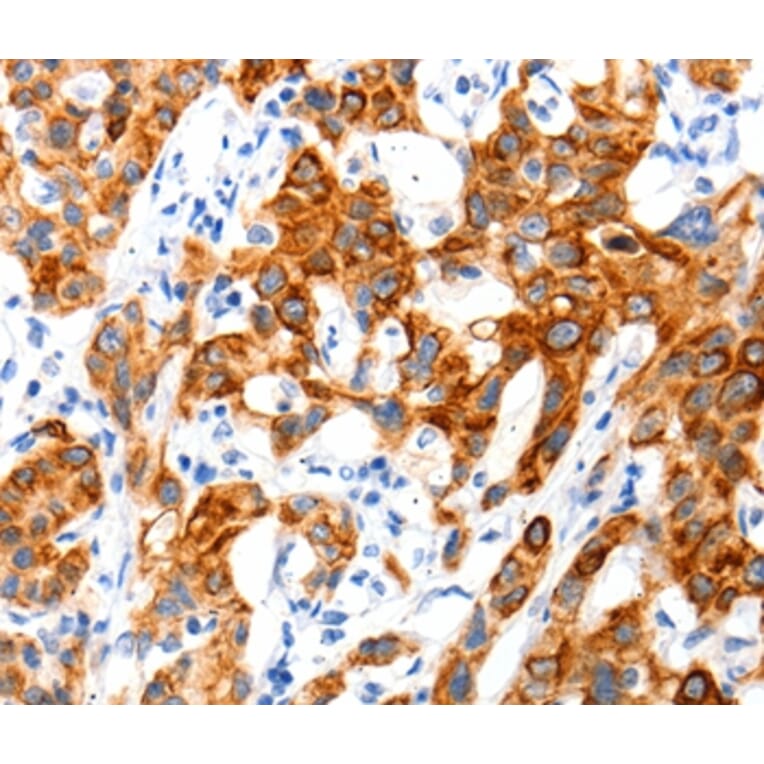 Immunohistochemistry - SLC2A11 Antibody from Signalway Antibody (36905) - Antibodies.com