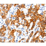 Immunohistochemistry - SLC2A11 Antibody from Signalway Antibody (36905) - Antibodies.com