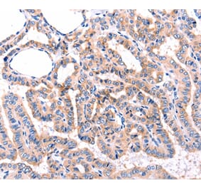 Immunohistochemistry - ADRBK1 Antibody from Signalway Antibody (36916) - Antibodies.com