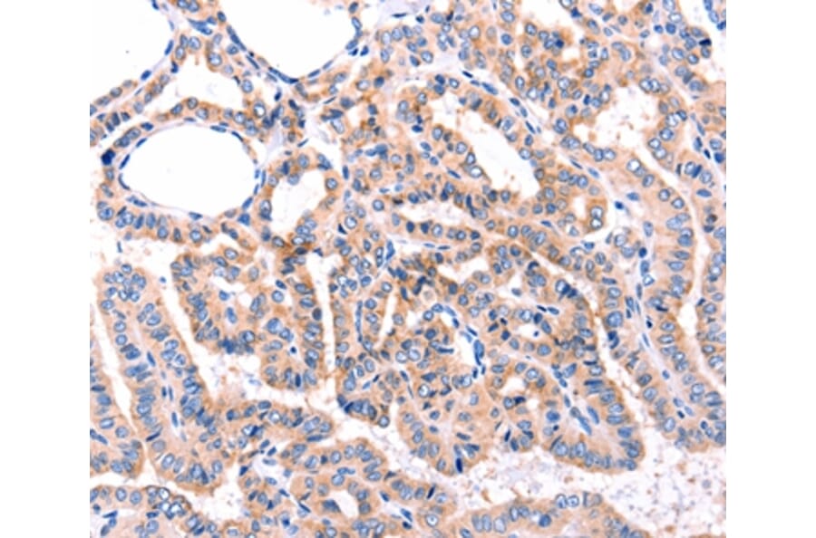 Immunohistochemistry - ADRBK1 Antibody from Signalway Antibody (36916) - Antibodies.com