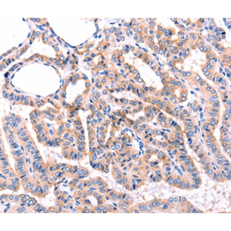 Immunohistochemistry - ADRBK1 Antibody from Signalway Antibody (36916) - Antibodies.com