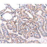 Immunohistochemistry - ADRBK1 Antibody from Signalway Antibody (36916) - Antibodies.com
