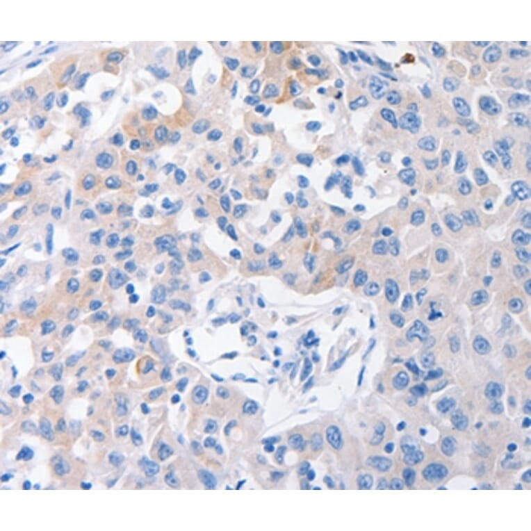 Immunohistochemistry - SLC10A1 Antibody from Signalway Antibody (37005) - Antibodies.com