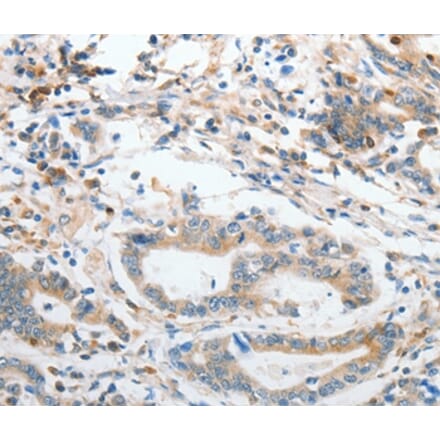 Immunohistochemistry - SLC15A2 Antibody from Signalway Antibody (37016) - Antibodies.com