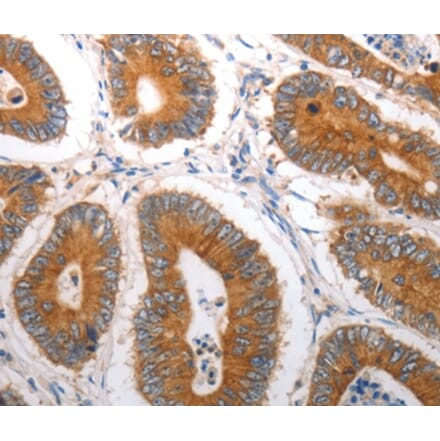 Immunohistochemistry - SLC12A6 Antibody from Signalway Antibody (37030) - Antibodies.com