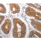 Immunohistochemistry - SLC12A6 Antibody from Signalway Antibody (37030) - Antibodies.com