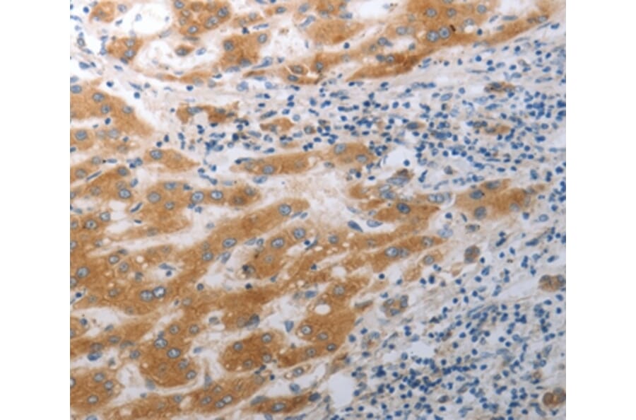 Immunohistochemistry - SLC12A6 Antibody from Signalway Antibody (37030) - Antibodies.com