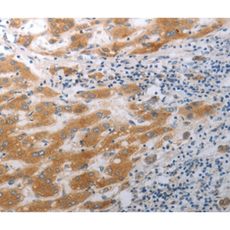 Immunohistochemistry - SLC12A6 Antibody from Signalway Antibody (37030) - Antibodies.com