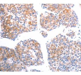 Immunohistochemistry - SLC44A1 Antibody from Signalway Antibody (37033) - Antibodies.com