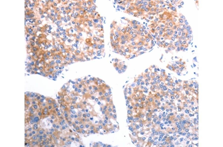 Immunohistochemistry - SLC44A1 Antibody from Signalway Antibody (37033) - Antibodies.com