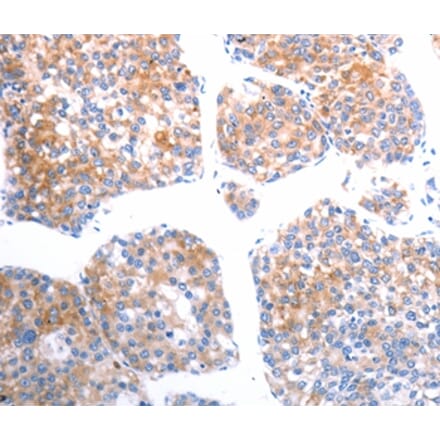 Immunohistochemistry - SLC44A1 Antibody from Signalway Antibody (37033) - Antibodies.com