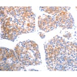 Immunohistochemistry - SLC44A1 Antibody from Signalway Antibody (37033) - Antibodies.com