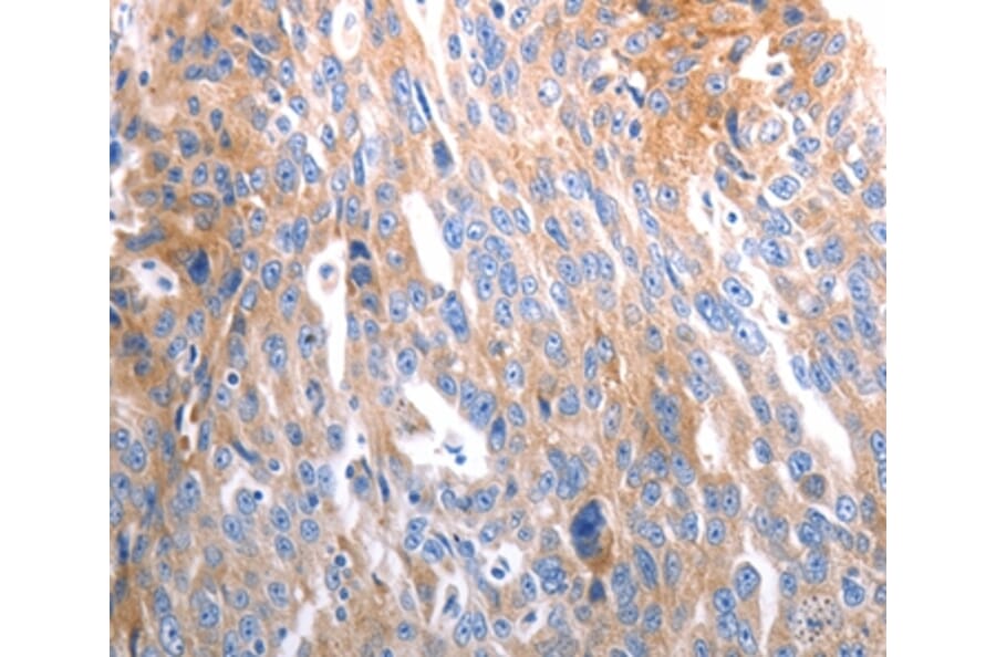Immunohistochemistry - SLC44A1 Antibody from Signalway Antibody (37033) - Antibodies.com