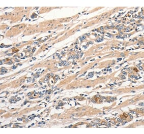 Immunohistochemistry - SLC44A2 Antibody from Signalway Antibody (37034) - Antibodies.com