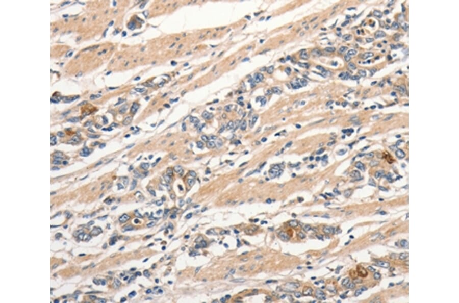 Immunohistochemistry - SLC44A2 Antibody from Signalway Antibody (37034) - Antibodies.com