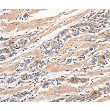 Immunohistochemistry - SLC44A2 Antibody from Signalway Antibody (37034) - Antibodies.com