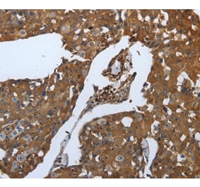 Immunohistochemistry - SLC34A2 Antibody from Signalway Antibody (37035) - Antibodies.com