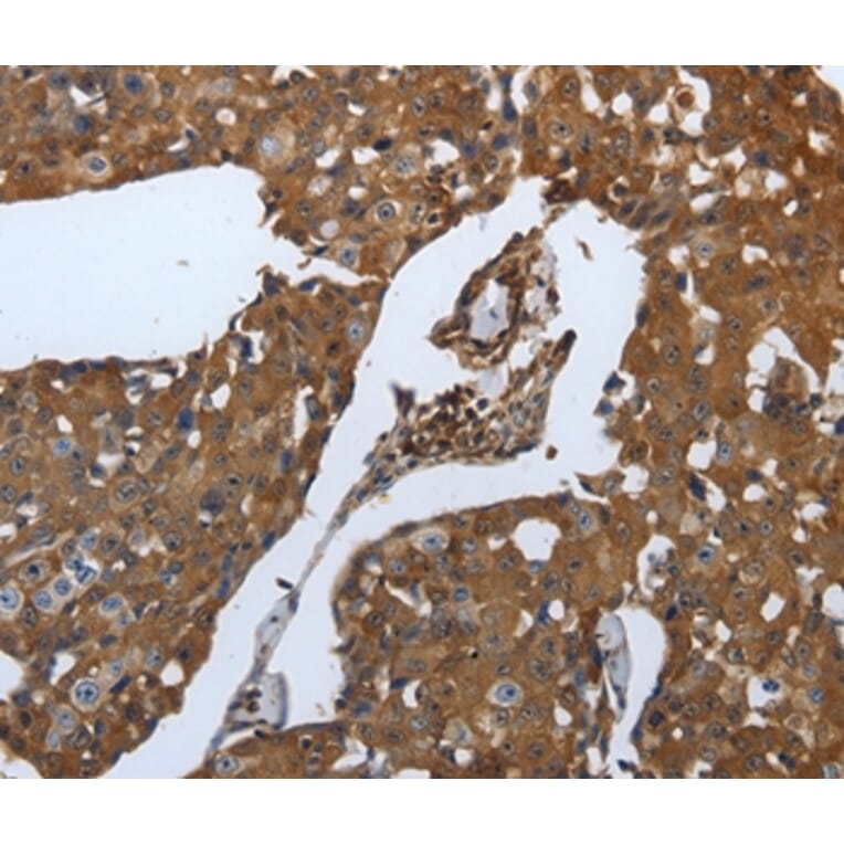 Immunohistochemistry - SLC34A2 Antibody from Signalway Antibody (37035) - Antibodies.com
