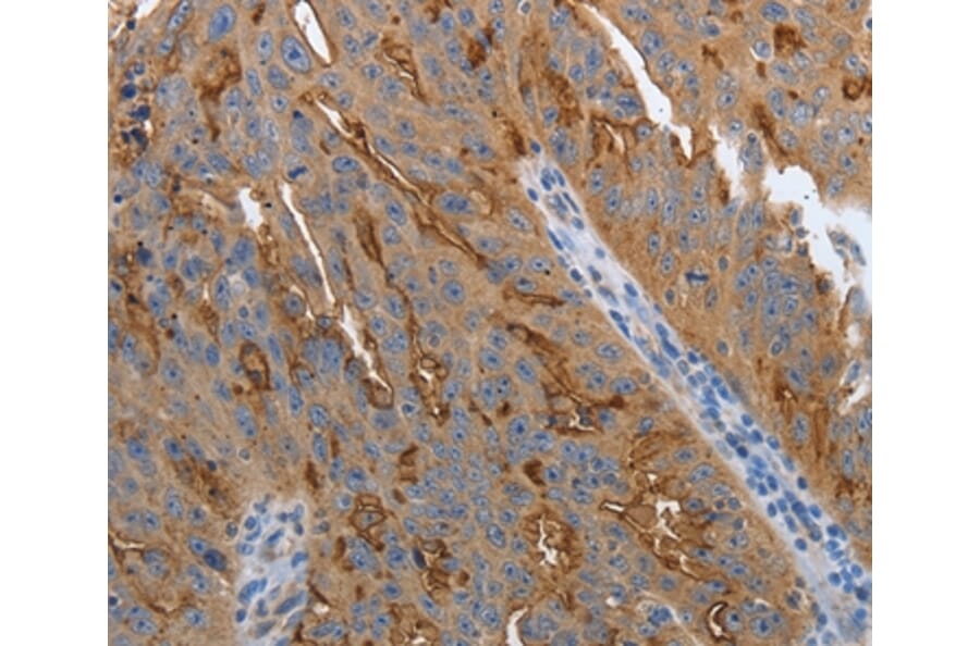 Immunohistochemistry - SLC34A2 Antibody from Signalway Antibody (37035) - Antibodies.com