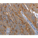 Immunohistochemistry - SLC34A2 Antibody from Signalway Antibody (37035) - Antibodies.com