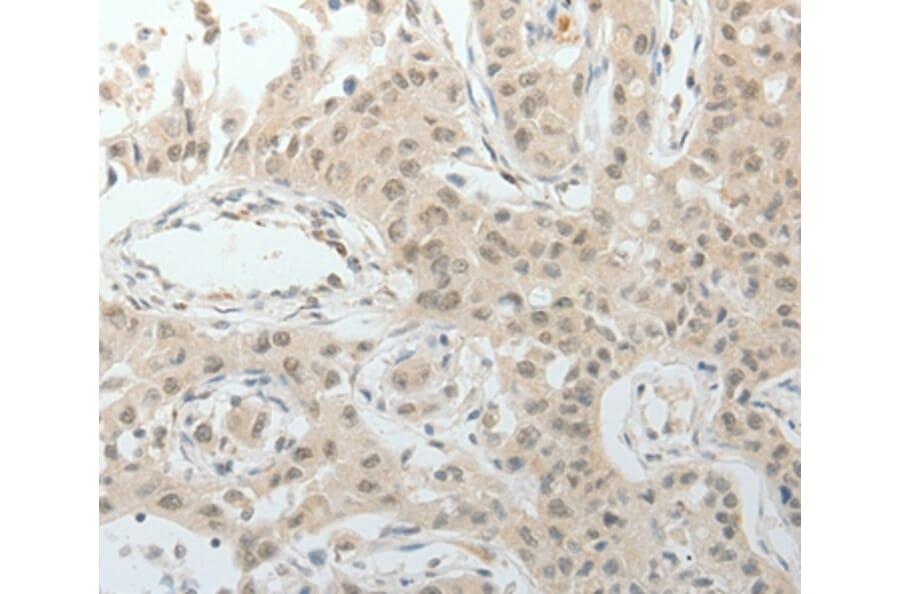 Immunohistochemistry - TOP1MT Antibody from Signalway Antibody (37052) - Antibodies.com