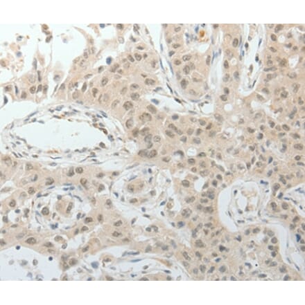 Immunohistochemistry - TOP1MT Antibody from Signalway Antibody (37052) - Antibodies.com