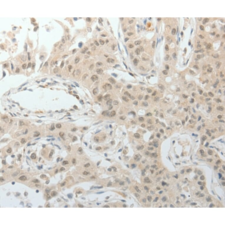 Immunohistochemistry - TOP1MT Antibody from Signalway Antibody (37052) - Antibodies.com