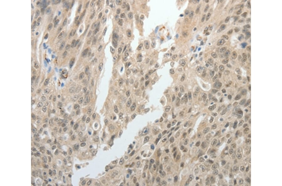 Immunohistochemistry - TOP1MT Antibody from Signalway Antibody (37052) - Antibodies.com