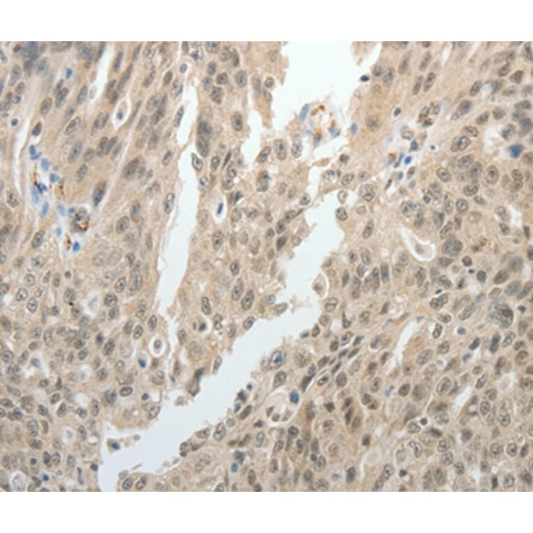 Immunohistochemistry - TOP1MT Antibody from Signalway Antibody (37052) - Antibodies.com