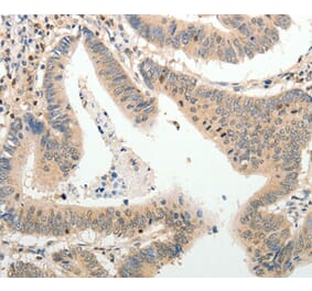 Immunohistochemistry - ADAMTS2 Antibody from Signalway Antibody (37082) - Antibodies.com