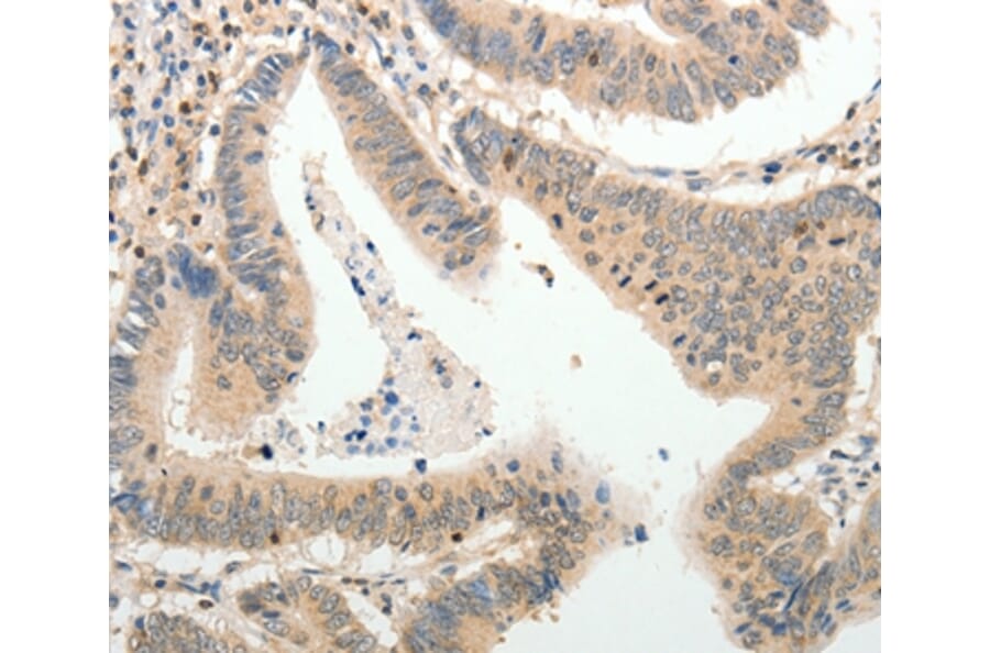 Immunohistochemistry - ADAMTS2 Antibody from Signalway Antibody (37082) - Antibodies.com