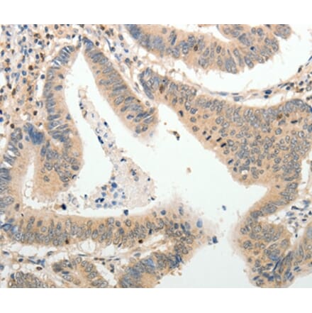 Immunohistochemistry - ADAMTS2 Antibody from Signalway Antibody (37082) - Antibodies.com