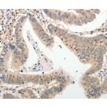 Immunohistochemistry - ADAMTS2 Antibody from Signalway Antibody (37082) - Antibodies.com