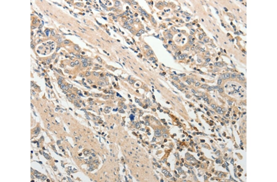 Immunohistochemistry - ADAMTS2 Antibody from Signalway Antibody (37082) - Antibodies.com