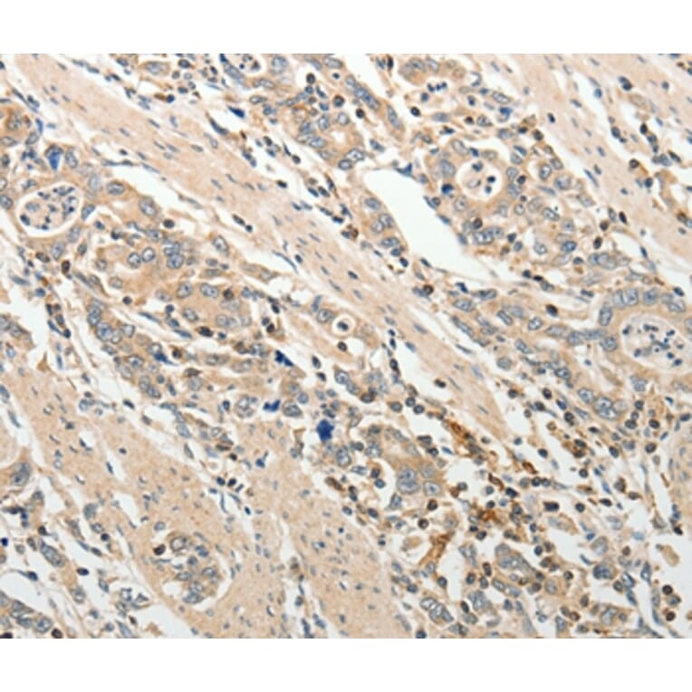 Immunohistochemistry - ADAMTS2 Antibody from Signalway Antibody (37082) - Antibodies.com