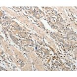 Immunohistochemistry - ADAMTS2 Antibody from Signalway Antibody (37082) - Antibodies.com