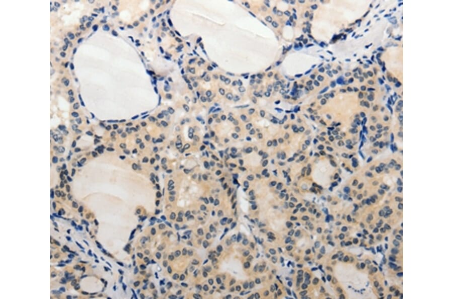 Immunohistochemistry - ADAMTS6 Antibody from Signalway Antibody (37083) - Antibodies.com