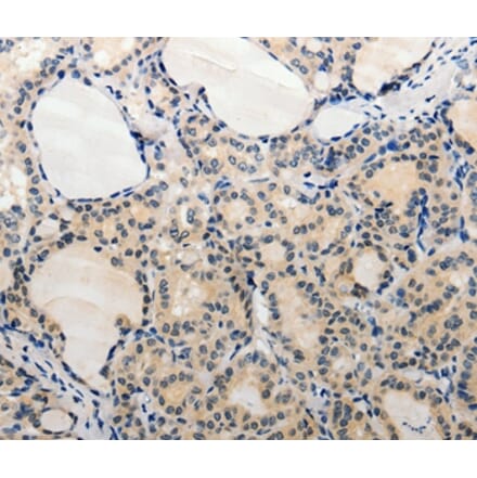 Immunohistochemistry - ADAMTS6 Antibody from Signalway Antibody (37083) - Antibodies.com