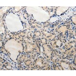 Immunohistochemistry - ADAMTS6 Antibody from Signalway Antibody (37083) - Antibodies.com