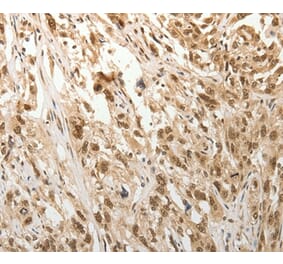 Immunohistochemistry - ADIPOR2 Antibody from Signalway Antibody (37086) - Antibodies.com