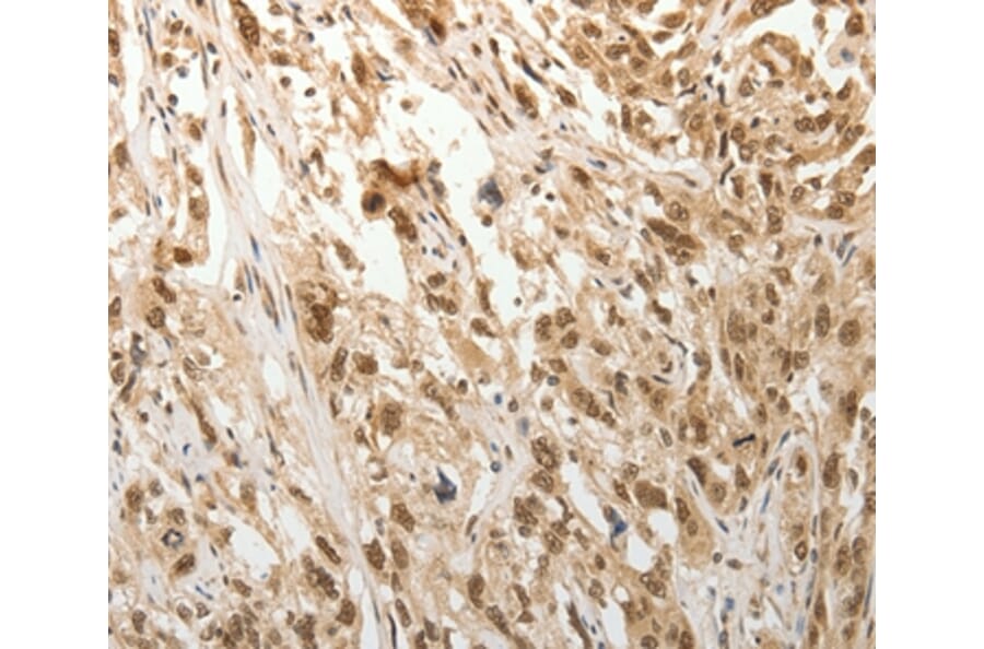 Immunohistochemistry - ADIPOR2 Antibody from Signalway Antibody (37086) - Antibodies.com